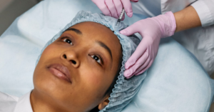 forehead filler